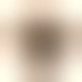 Blurred, unrevealed concept NFT artwork — BREAKOUT edition